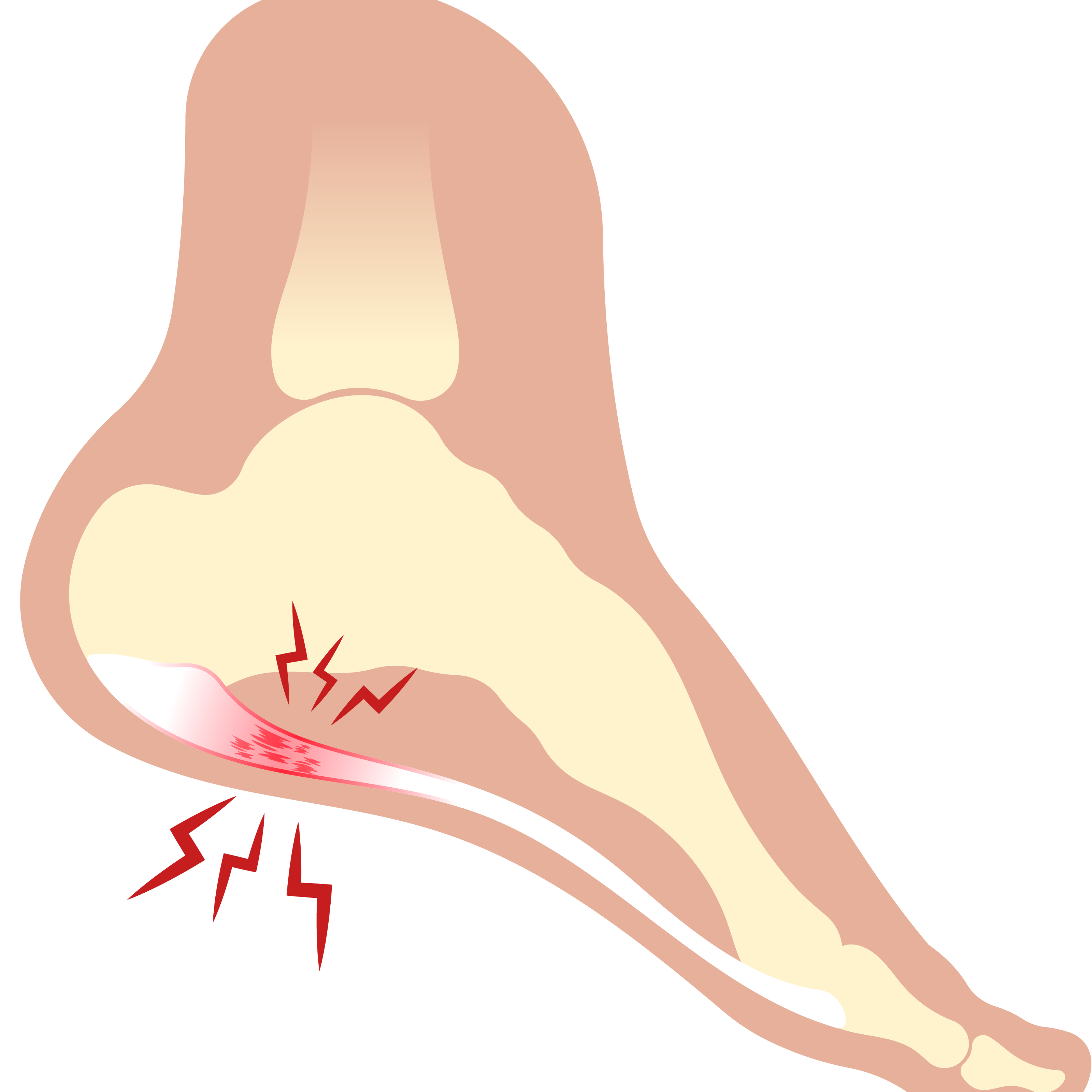 Ligament or tendon damage